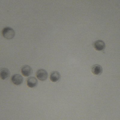 Embriones (Blastocistos la mayoría) de calidad 1. Corresponde a 6-1 según IETS. Foto: Cesar Gomez V.