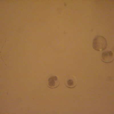 Estructuras en diferente estado de desarrollo. Nótese una estructura sin fertilizar. Foto: Cesar Gomez V.